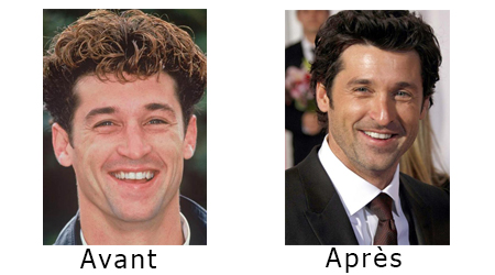 Patrick-Dempsey-chirurgie-esthetique