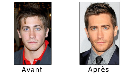 jake-gyllenhaal-chirurgie-esthetique