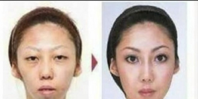Chirurgie du visage
