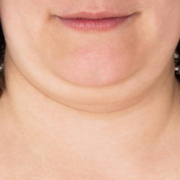 هكذا تتخلصون من الذقن المزدوج