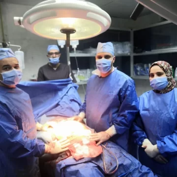 مستشفى جامعة الازهر دمياط: للمرة الثامنة على التوالي نجاح عملية ولادة قيصرية لسيدة بلغ وزنها 160 كيلوغرام