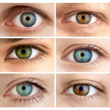 هل يمكن تغيير لون العين بالجراحة أو بالليزر؟