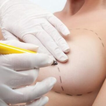 Lifting des seins VS Augmentation mammaire