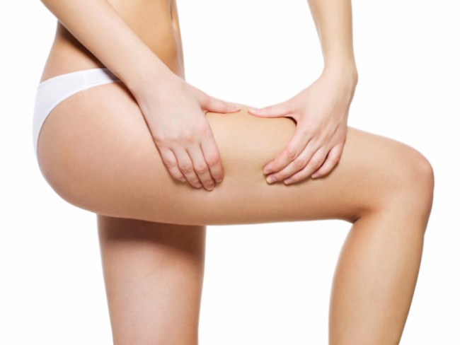 Traitement de la Cellulite par la liposuccion