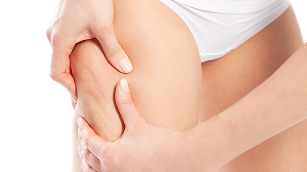 Patch anti-cellulite