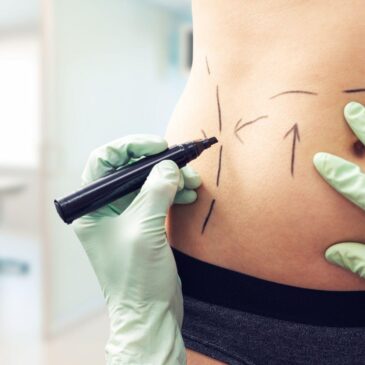 Comment la liposuccion aide-t-elle à façonner votre corps ?