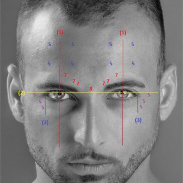 Des injections de toxine botulique pour homme : Est-ce efficace ?