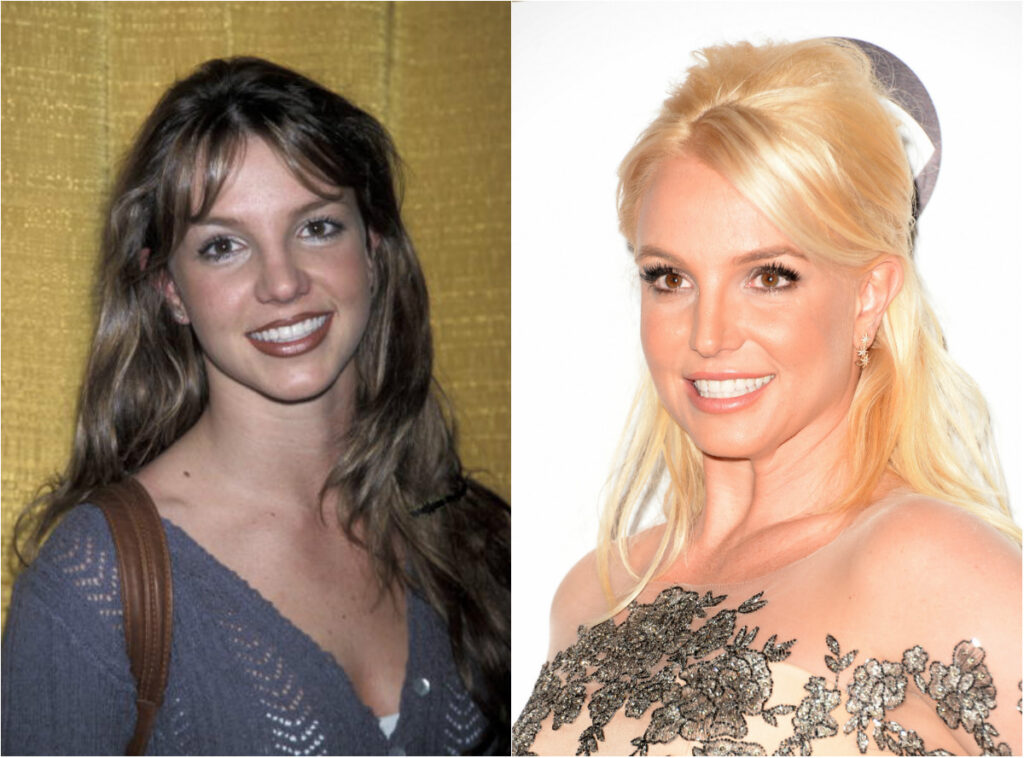 Britney Spears avant apres