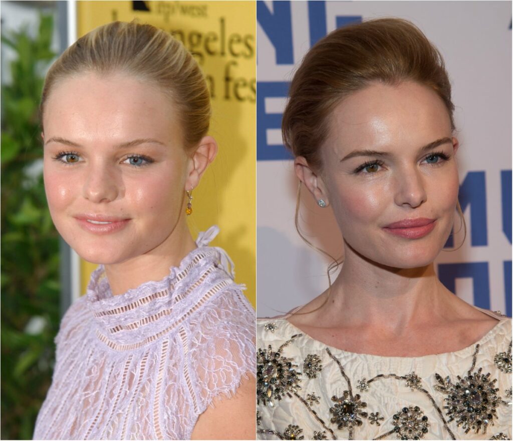 Kate Bosworth avant apres