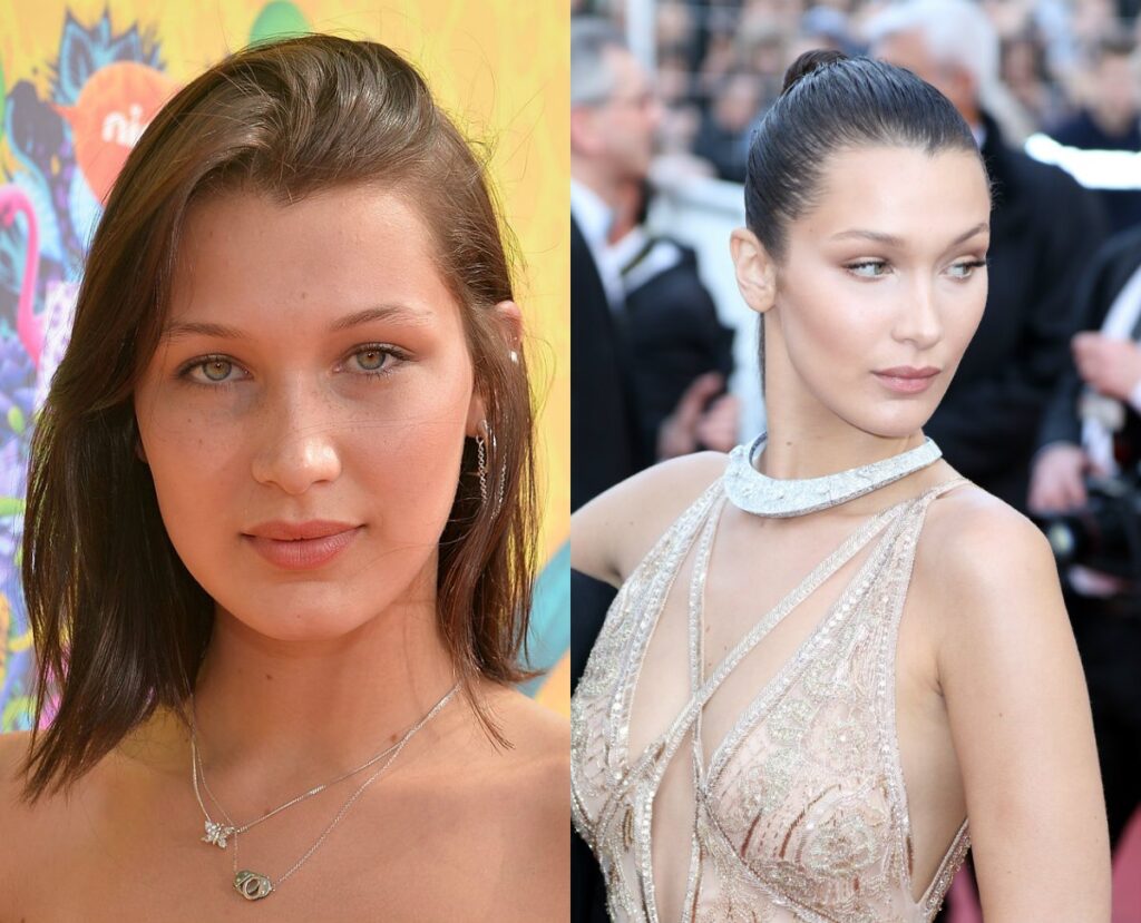 bella-hadid-avant-apres