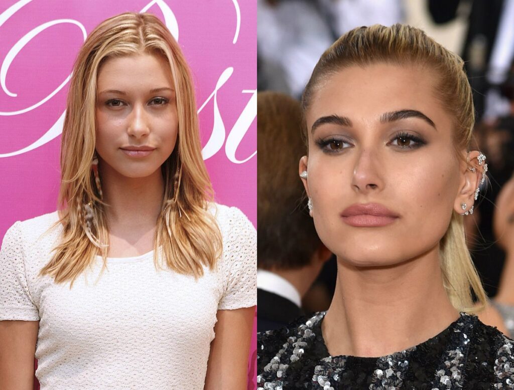 hailey-baldwin-avant-apres