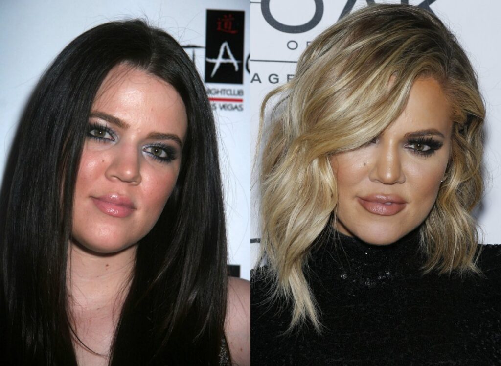 khloe kardashian avant apres