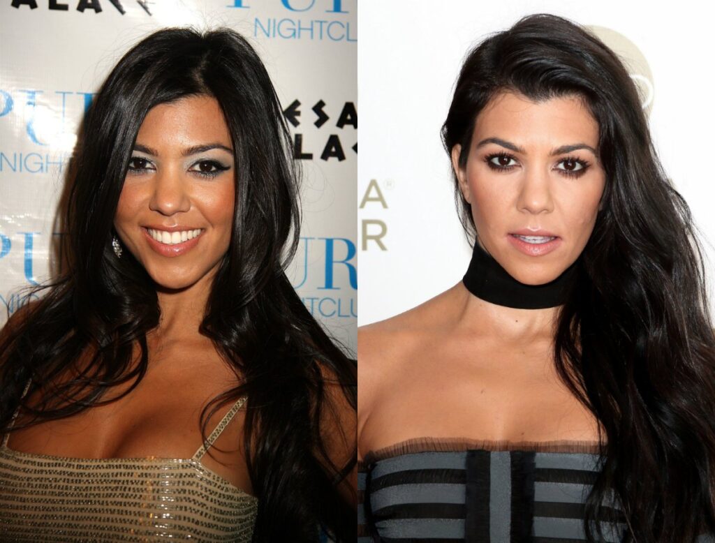 kourtney-kardashian-avant-apres