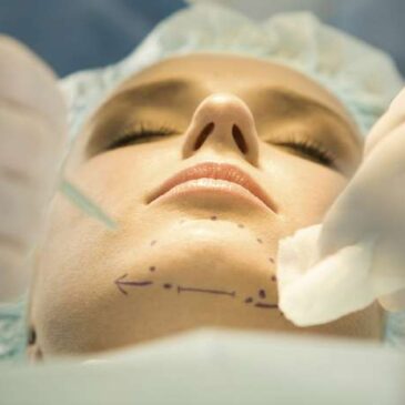 Liposuccion sous-mentale