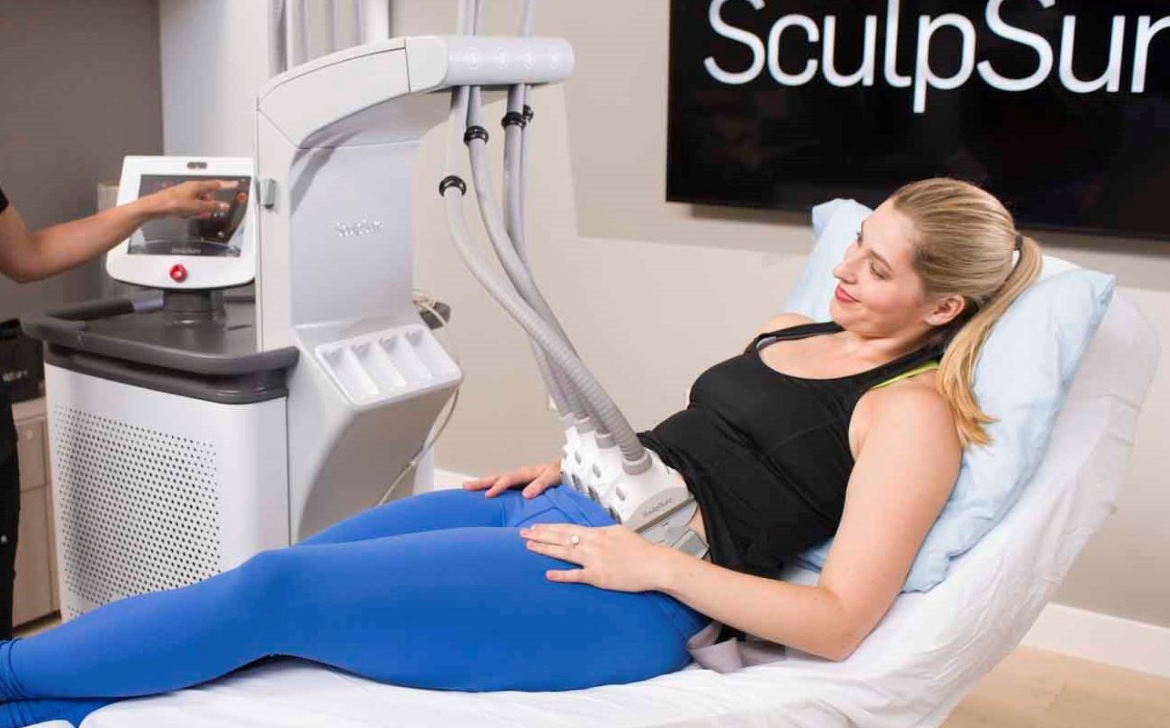 SculpSure ou liposuccion traditionnelle : Ce qu’il faut savoir