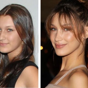 Bella Hadid et la chirurgie plastique !