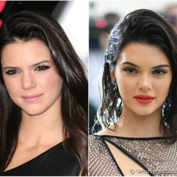 Kendall Jenner accro à la chirurgie esthétique ? Son visage nous dit la vérité !